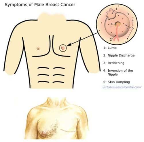 112 best I Am surviving Breast Cancer images on Pinterest