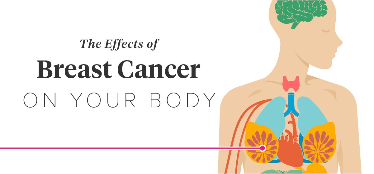 12 Effects of Breast Cancer on the Body
