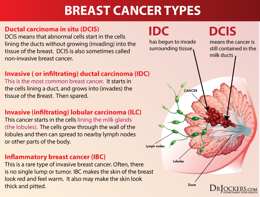12 Natural Strategies to Prevent Breast Cancer