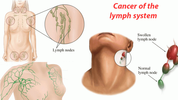 18 Warning Signs That Cancer is Growing in Your Body (Don ...