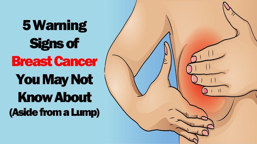 5 Warning Signs of Breast Cancer You May Not Know About ...