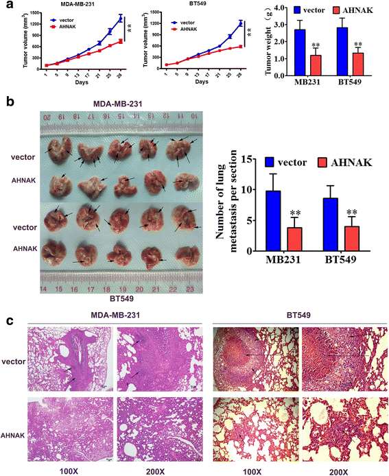 AHNAK suppresses tumour proliferation and invasion by targeting ...