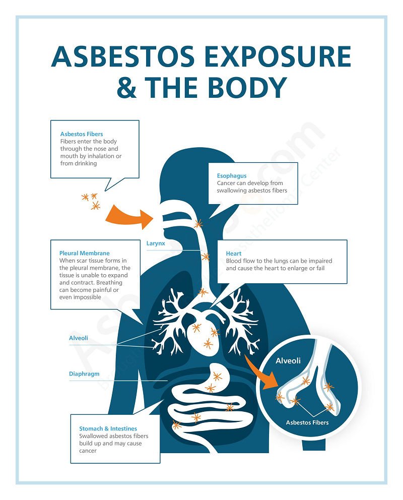 Asbestos Exposure Cancer Risk