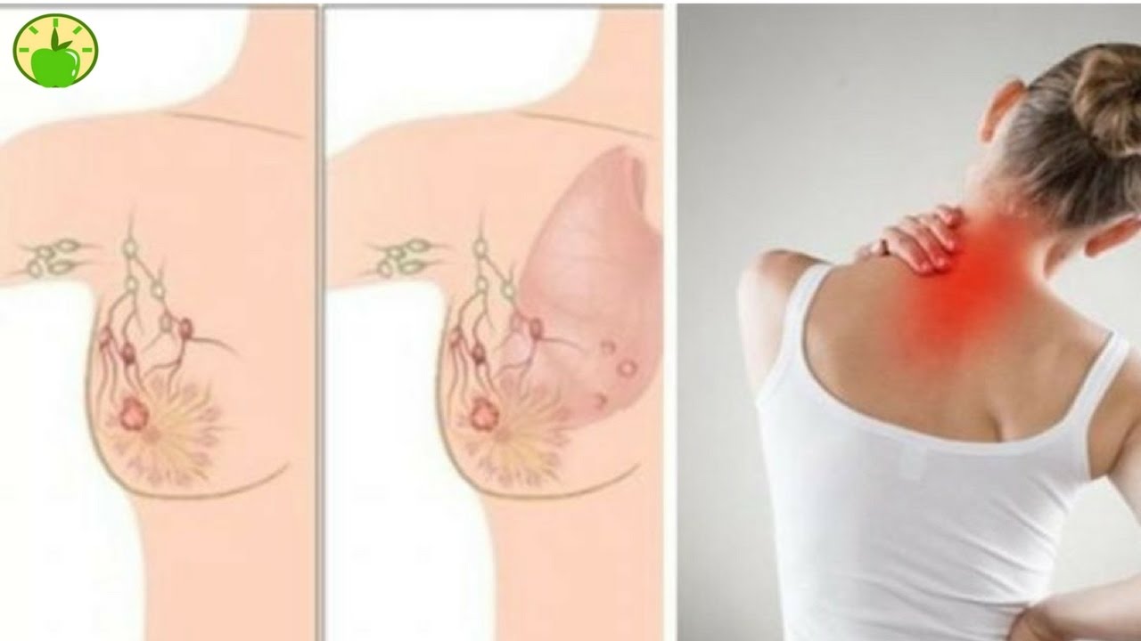 ATTENTION! 5 Warning Signs Of BREAST CANCER That Many ...