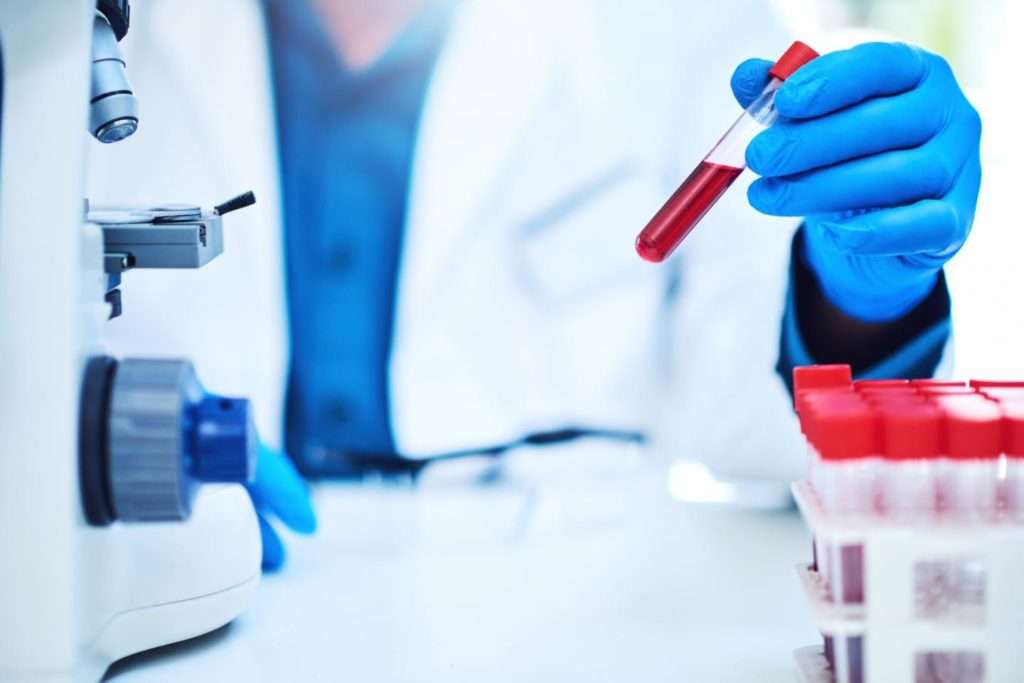 Blood Test Developed Using Machine Learning Enables Early
