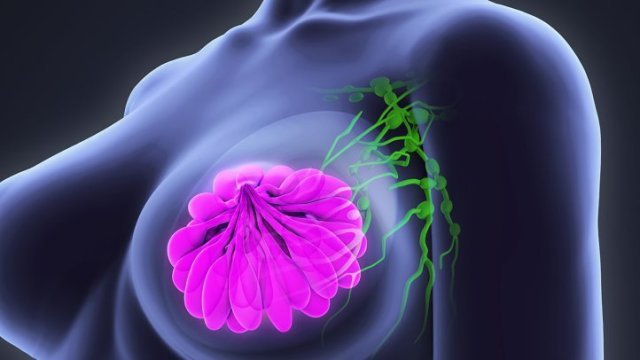 BREAST CANCER AND YOU  RISK FACTORS AND SAFETY PRECAUTIONS ...