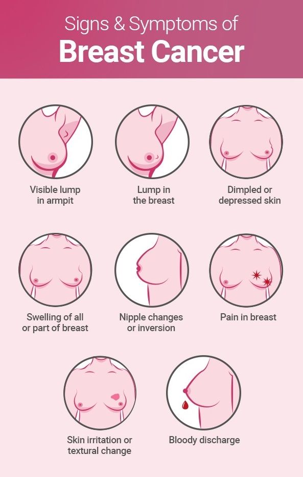 Breast Cancer, aspects you did not know.