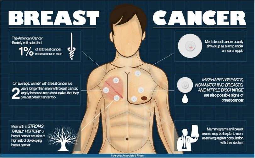 Breast Cancer Can and Does Happen to Men