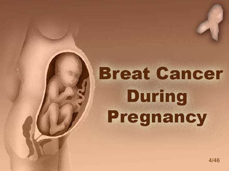 Breast Cancer during pregnancy