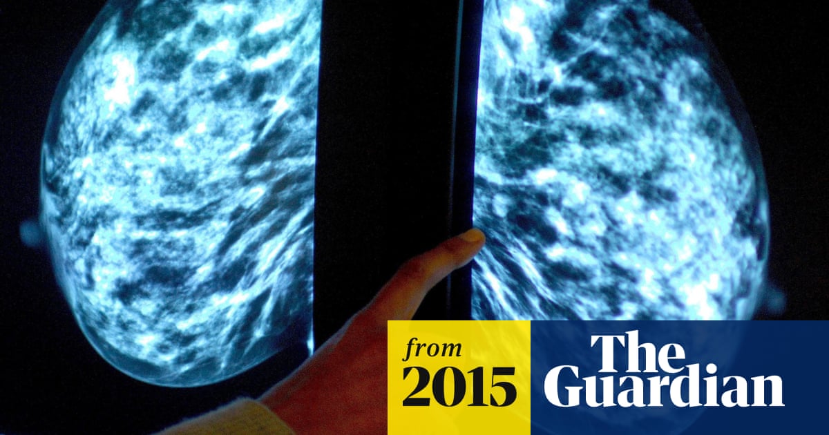 Breast cancer hope as hormone shown to slow tumour growth ...