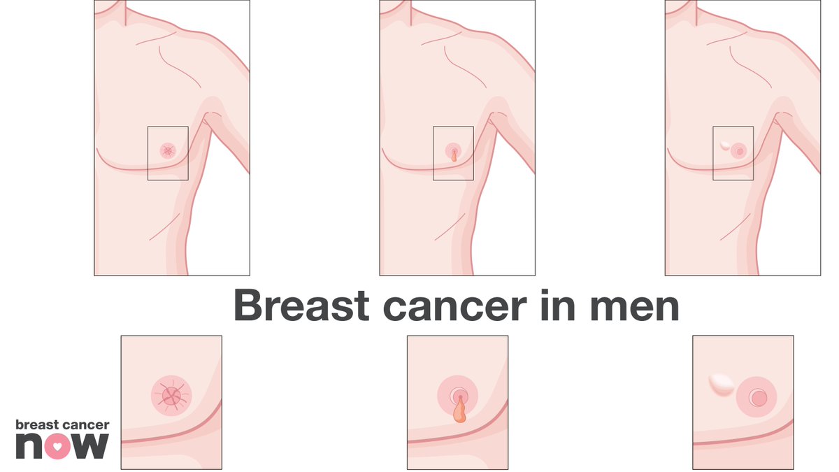Breast Cancer Now on Twitter: "Learn more about the signs ...