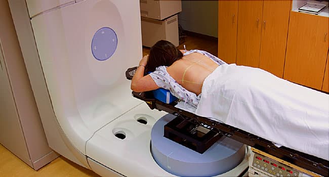 Breast Cancer Radiation Therapy Burns