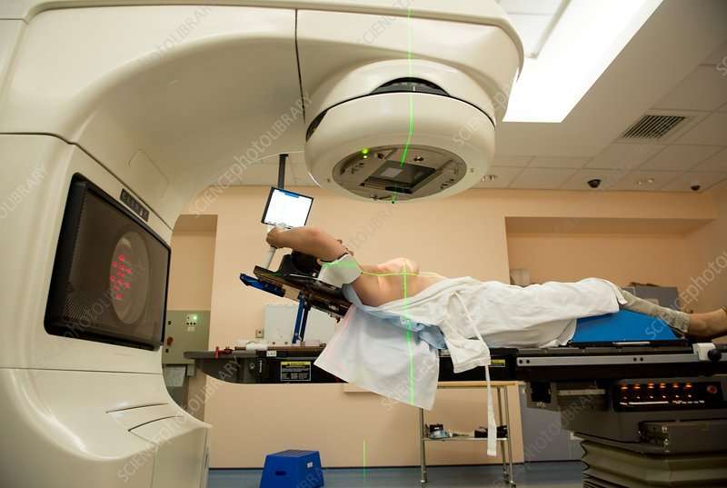 Breast cancer radiotherapy