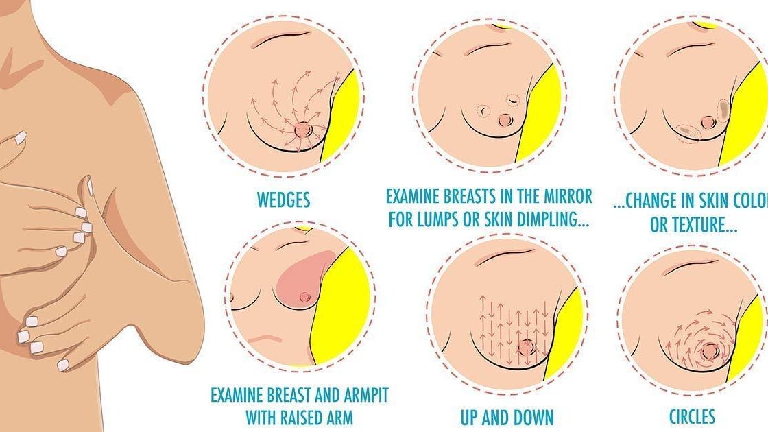 Breast Cancer Signs to be Aware Of