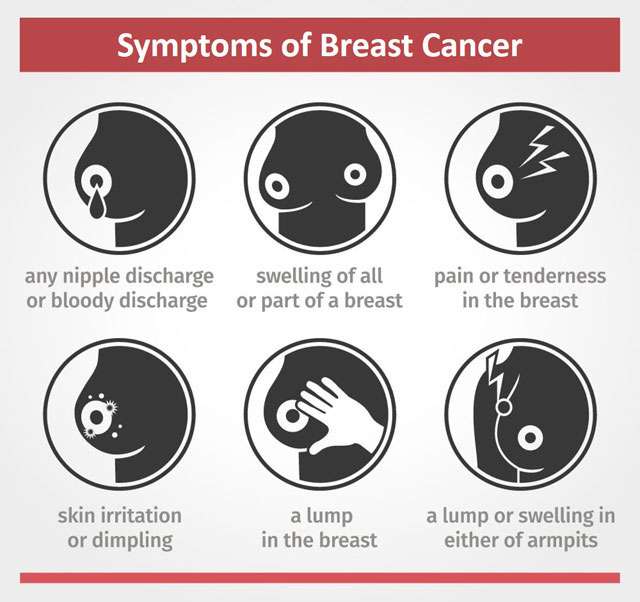 Breast Cancer  Stages, Symptoms &  Treatment
