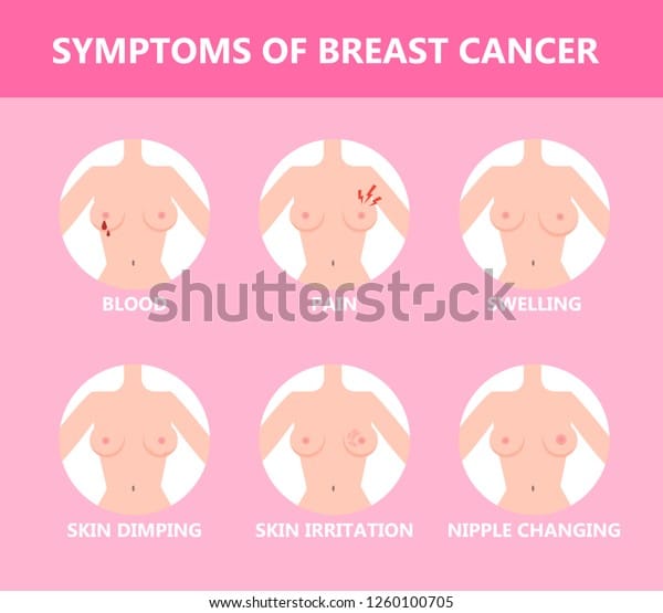Breast Cancer Symptom Idea Health Medical Stock Vector (Royalty Free ...