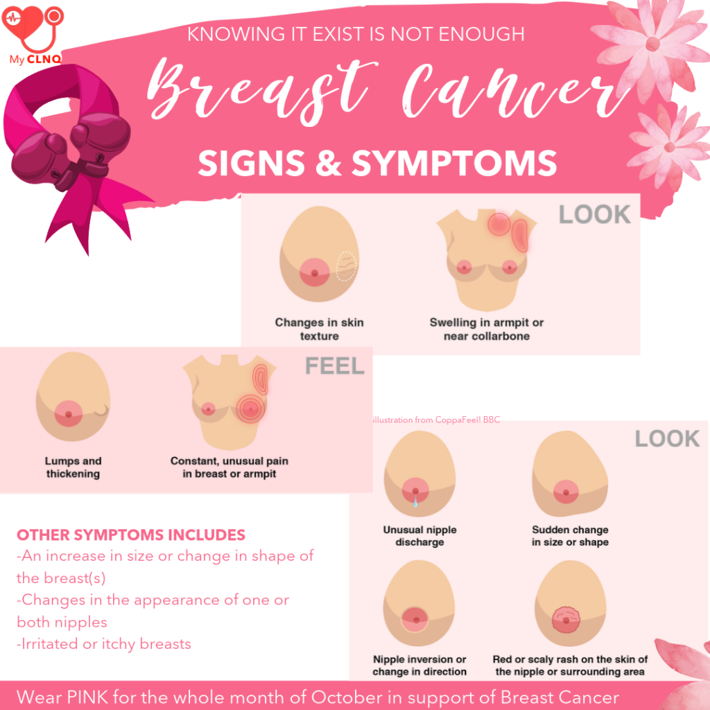 Breast Cancer : Symptoms and Signs. Lets bust the myth!  SSIVIX Lab