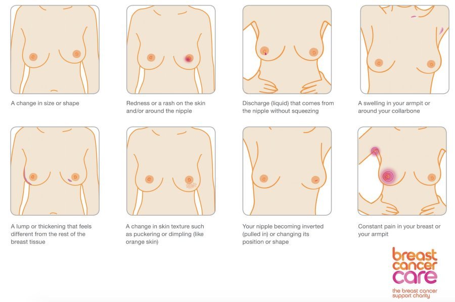 Breast Cancer Symptoms Are