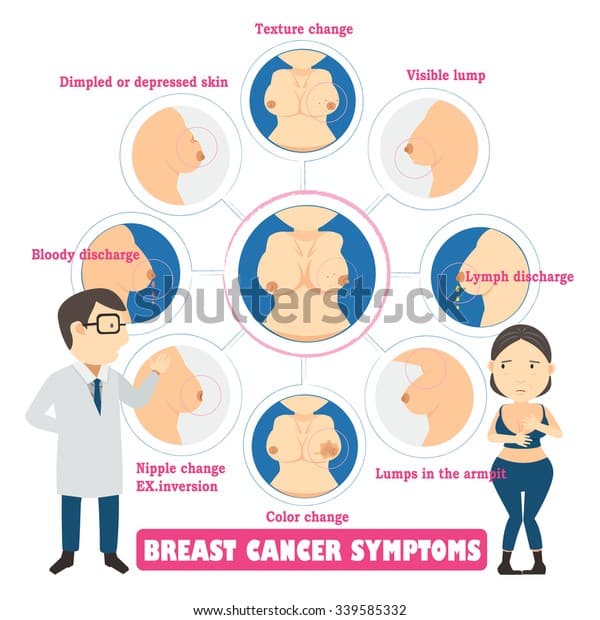 Breast Cancer Symptoms Circlesinfo Graphic Vector Stock Vector (Royalty ...