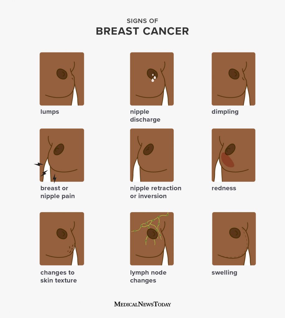 Breast cancer symptoms: Early signs, pictures, and more