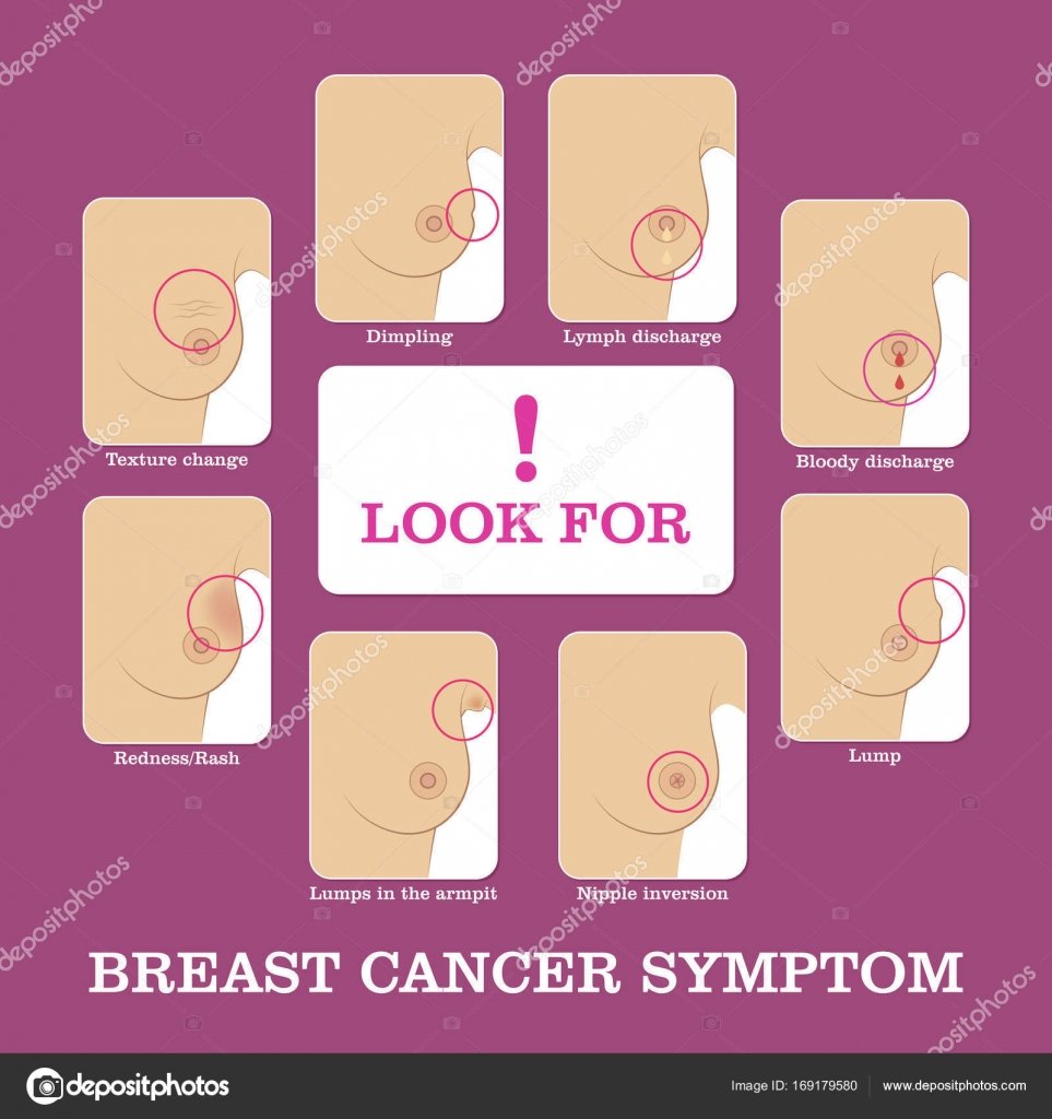 Breast cancer symptoms infographic â Stock Vector Â© nastya ...