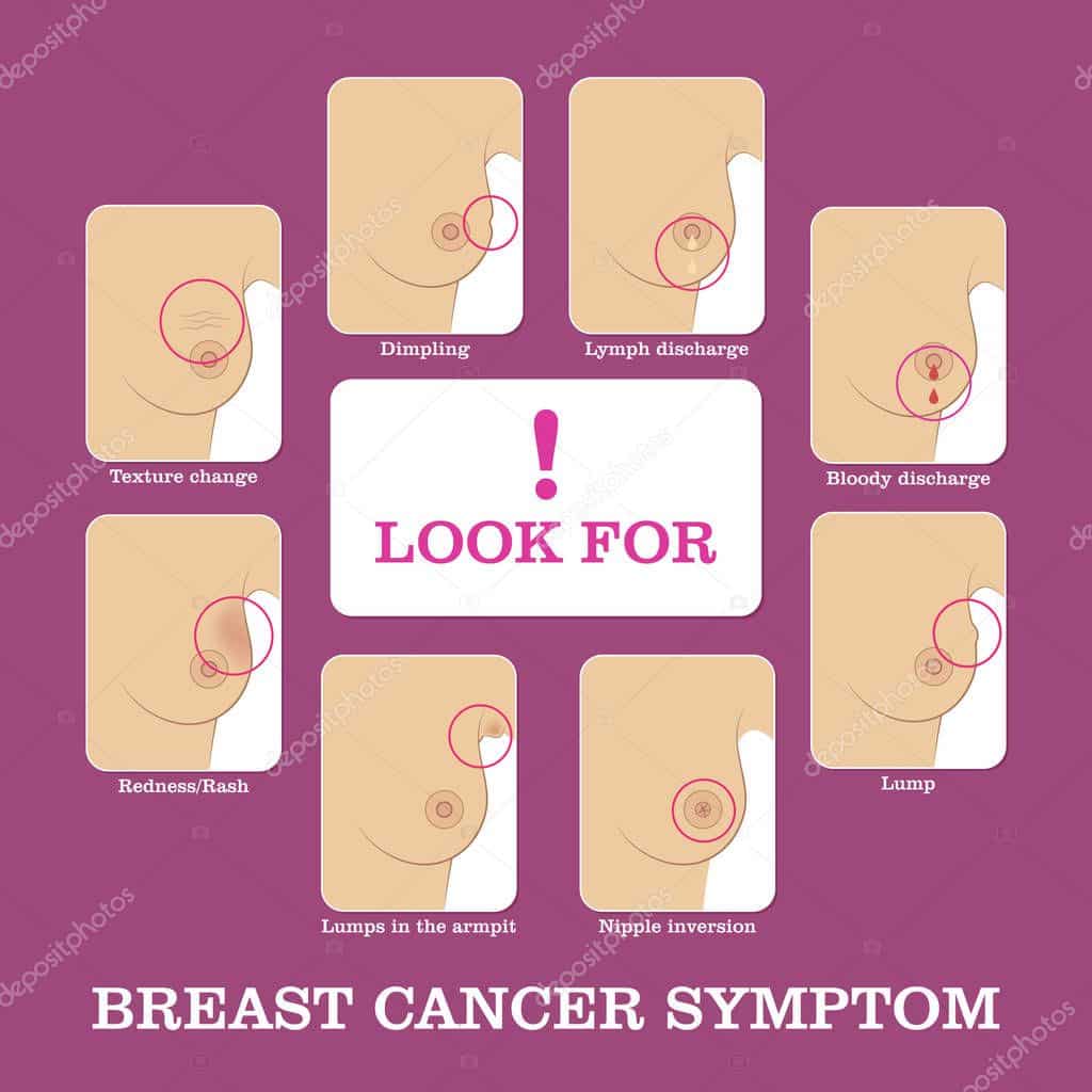 Breast cancer symptoms infographic  Stock Vector © nastya