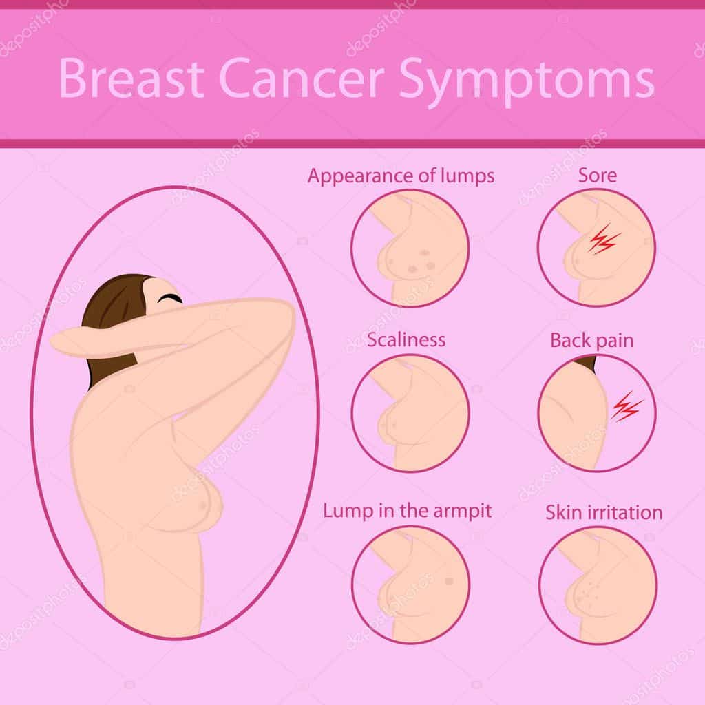 Breast cancer symptoms  Stock Vector © crazy.photoshoper2015.yandex.ua ...