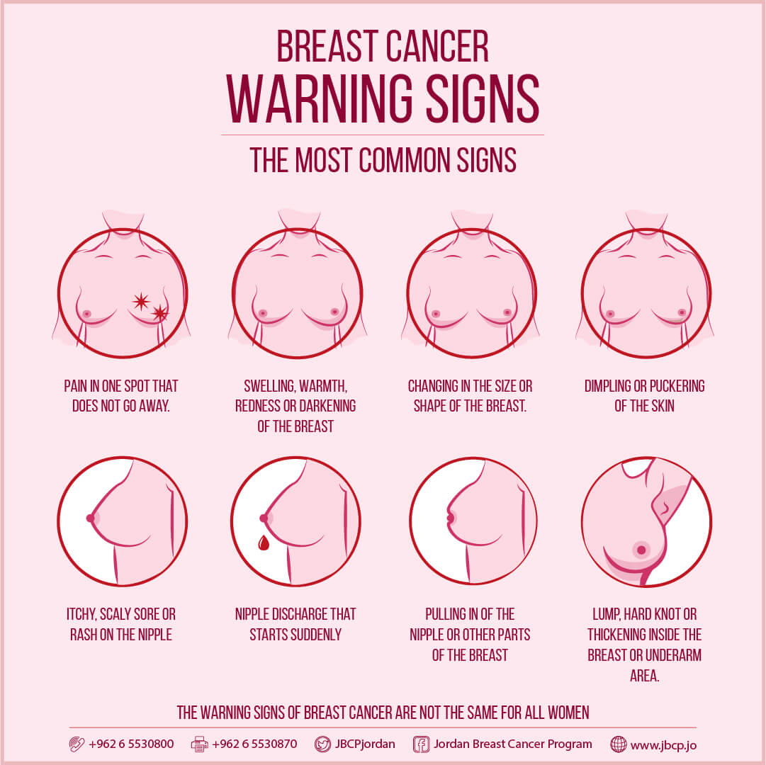 Breast Cancer Warning Signs