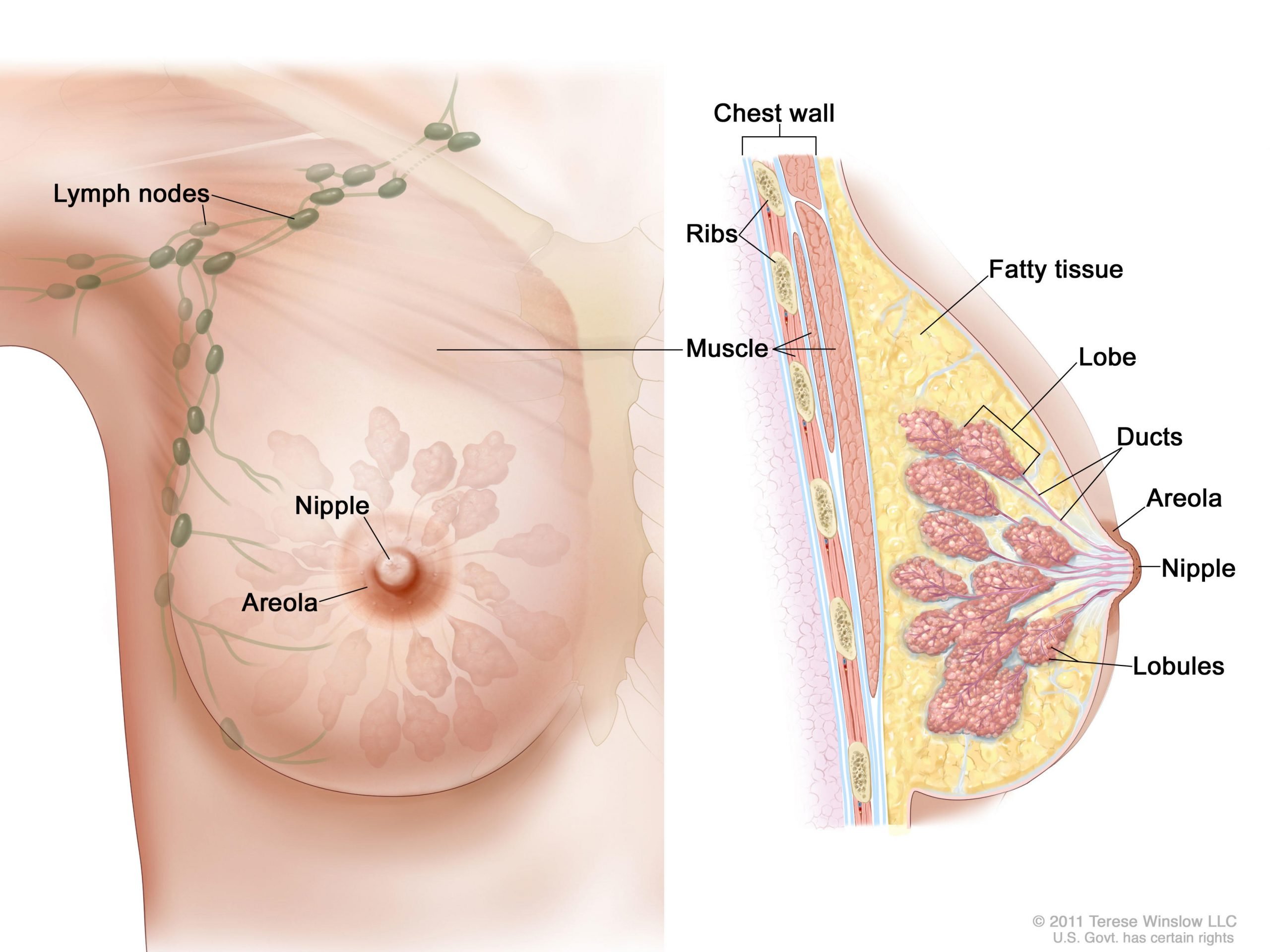 Breast CancerPatient Version