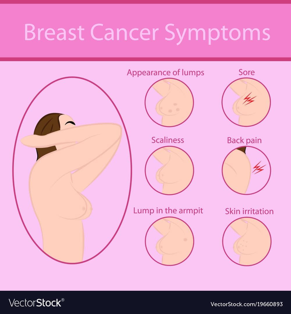 Cancer Signs And Symptoms Breast