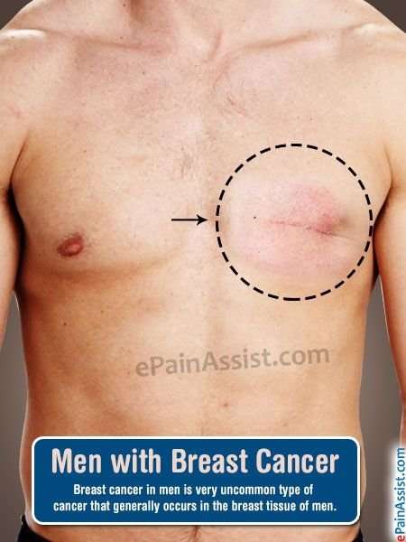 Chest Cancer Symptoms In Men