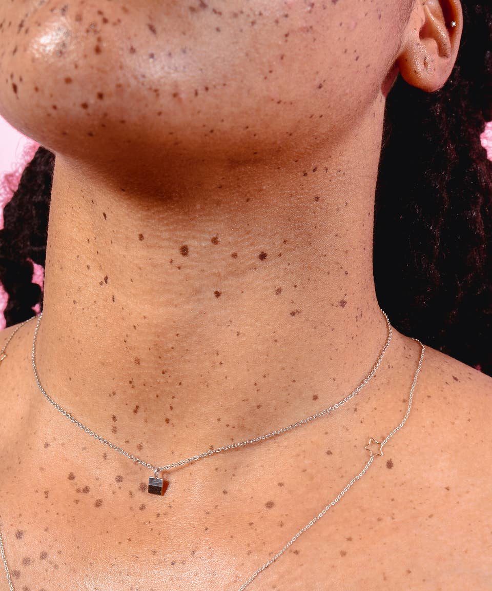 Chest Freckles Rare Inflammatory Breast Cancer Symptom