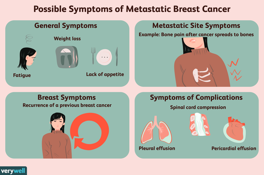 Common Symptoms of Metastatic Breast Cancer