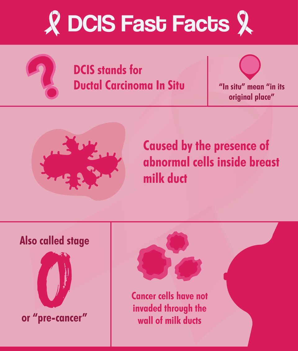 DCIS Breast Disease: 10 Things About Stage 0 Breast Cancer ...