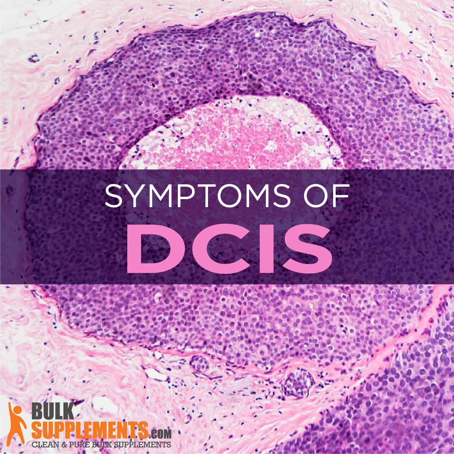 DCIS (Ductal Carcinoma in Situ): Symptoms, Causes &  Treatment