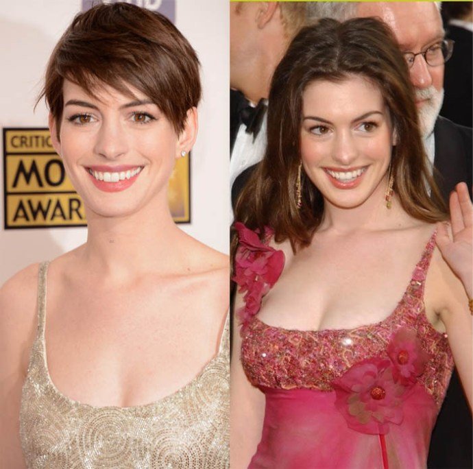 Did Anne Hathaway Get Plastic Surgery? Nose Job &  Breast ...