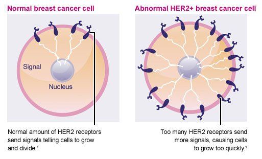 Different Types of Breast Cancer!!!  Crystals Technology