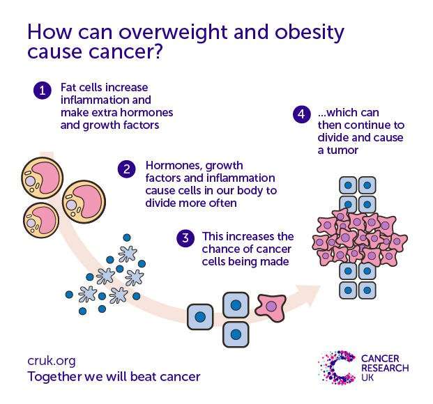 Does obesity cause cancer?