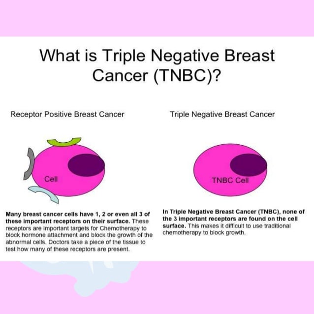 Dr arun Triple Negative Breast cancer Presentation