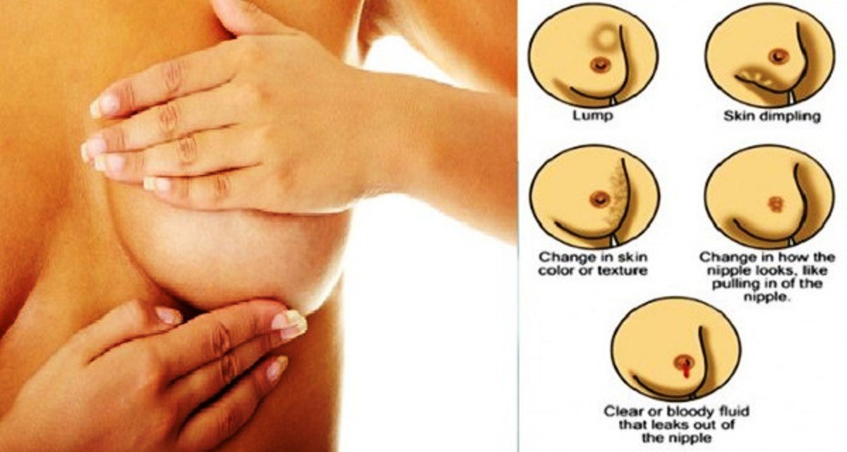 Early Warning Signs of Breast Cancer Nobody Talks About ...