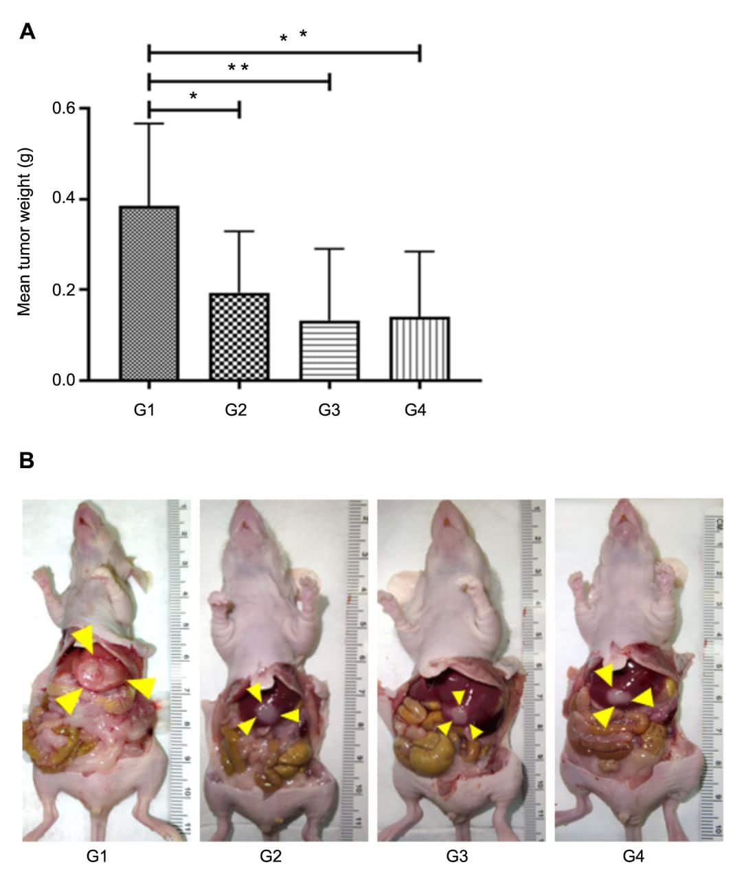 Efficacy of Oral Recombinant Methioninase and Eribulin on a PDOX Model ...