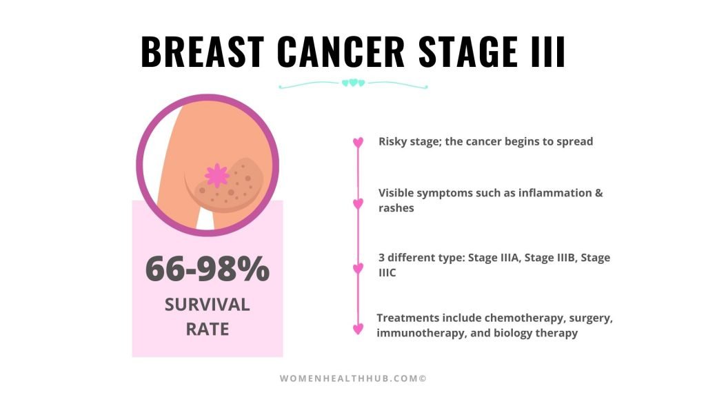 Everything About 5 Stages of Breast Cancer With Treatments