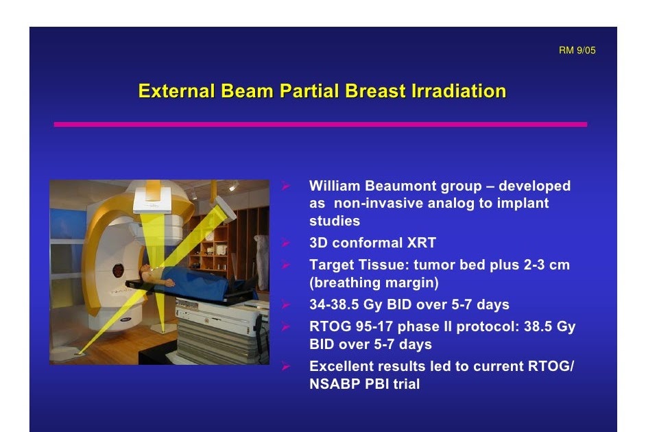 External Radiation Therapy In Breast Cancer