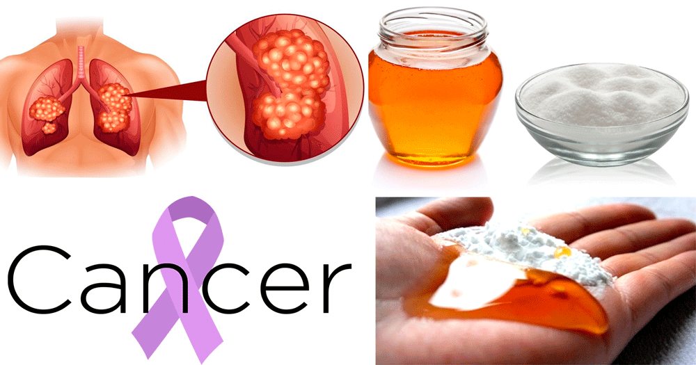 Get Rid of Cancer with two Simple Ingredients