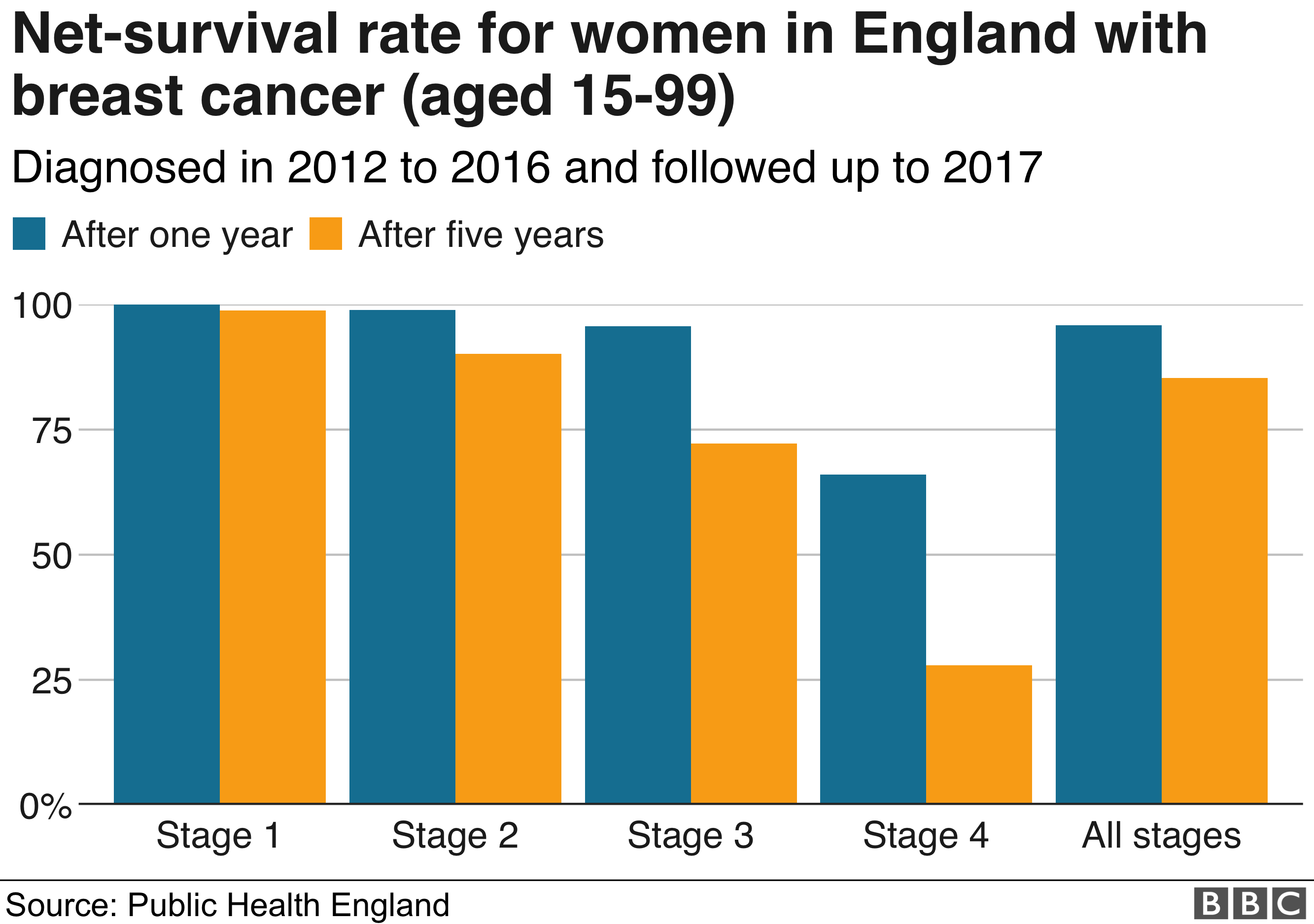 high survival for many cancers diagnosed at stages 1 3 bbc news