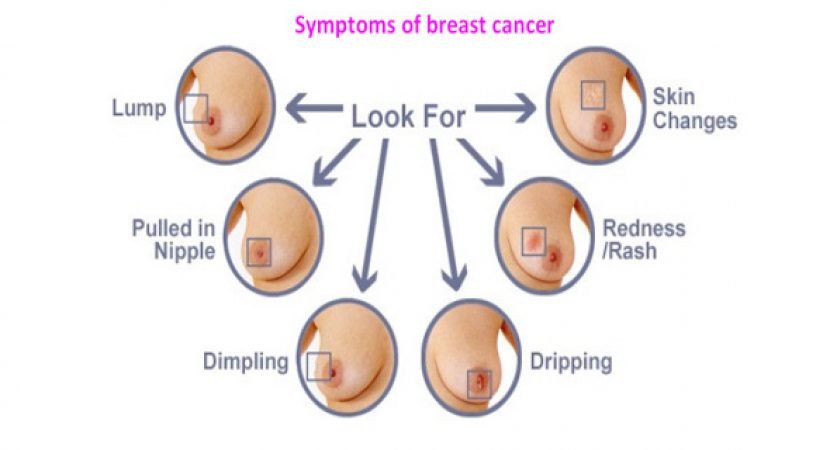 HOW CAN BREAST CANCER BE DETECTED  HEALTHY FOOD ADVICE