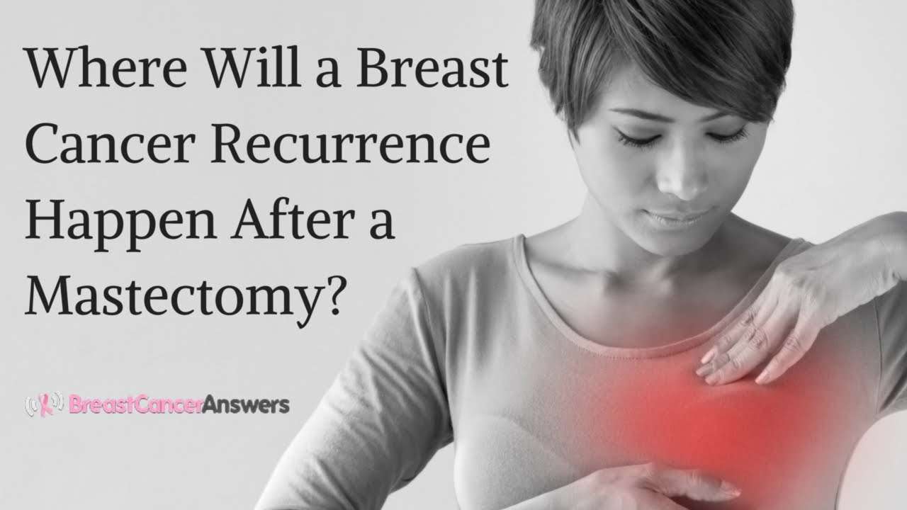 How Do I Know If My Breast Cancer Has Come Back : Breast Cancer Anatomy ...