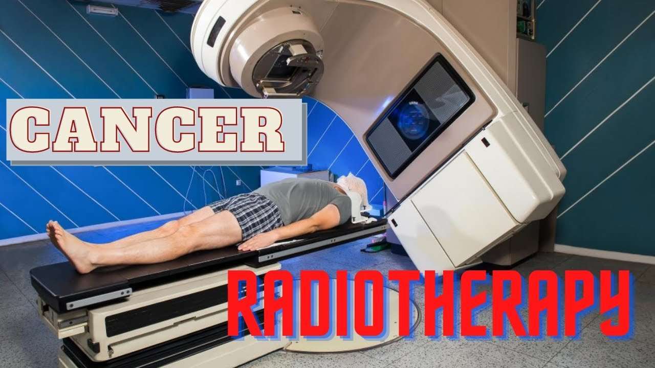 How Radiation Therapy Works/What are the side effects of ...