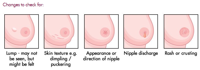 How to check for breast cancer