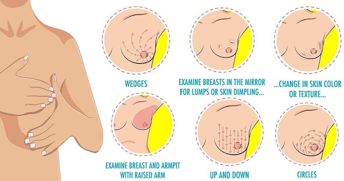 How to Perform a Breast Self